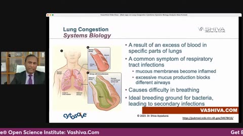 Dr.SHIVA™: Red Sage on Lung Congestion @CytoSolve® Systems Analysis (3/23)