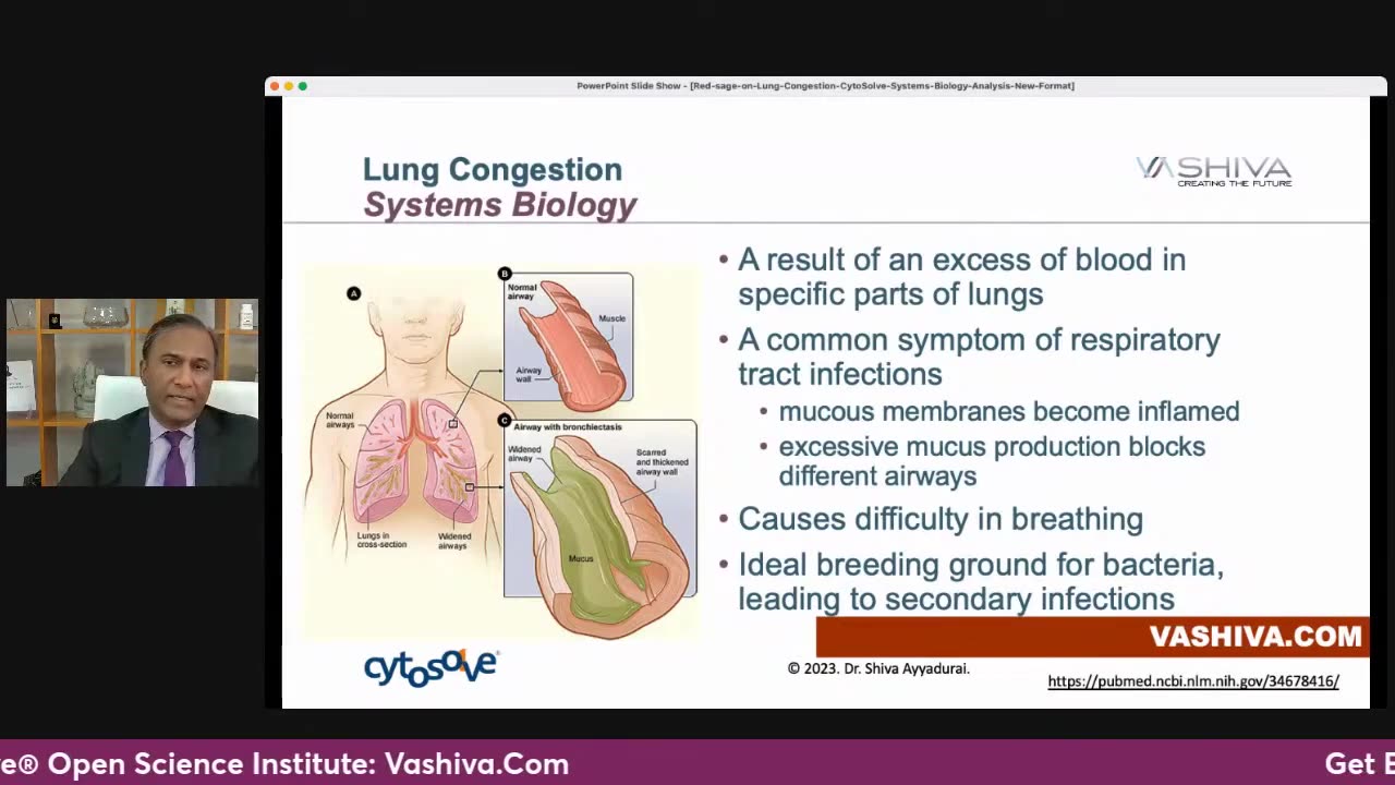 Dr.SHIVA™: Red Sage on Lung Congestion @CytoSolve® Systems Analysis (3/23)
