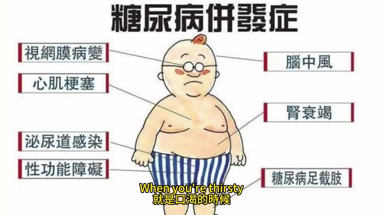 美1/3成年糖尿病 8成人不知風險
