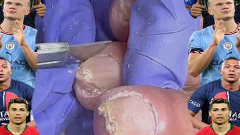 Cleaning is very needed! Home Service Pedicure Series #ingrowntoenail #toenails #pedicure (13)