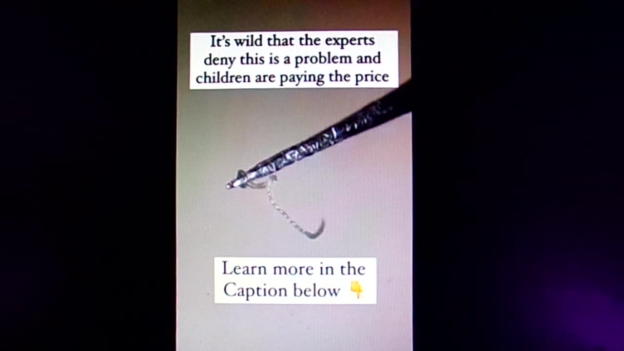 Parasites in meat: