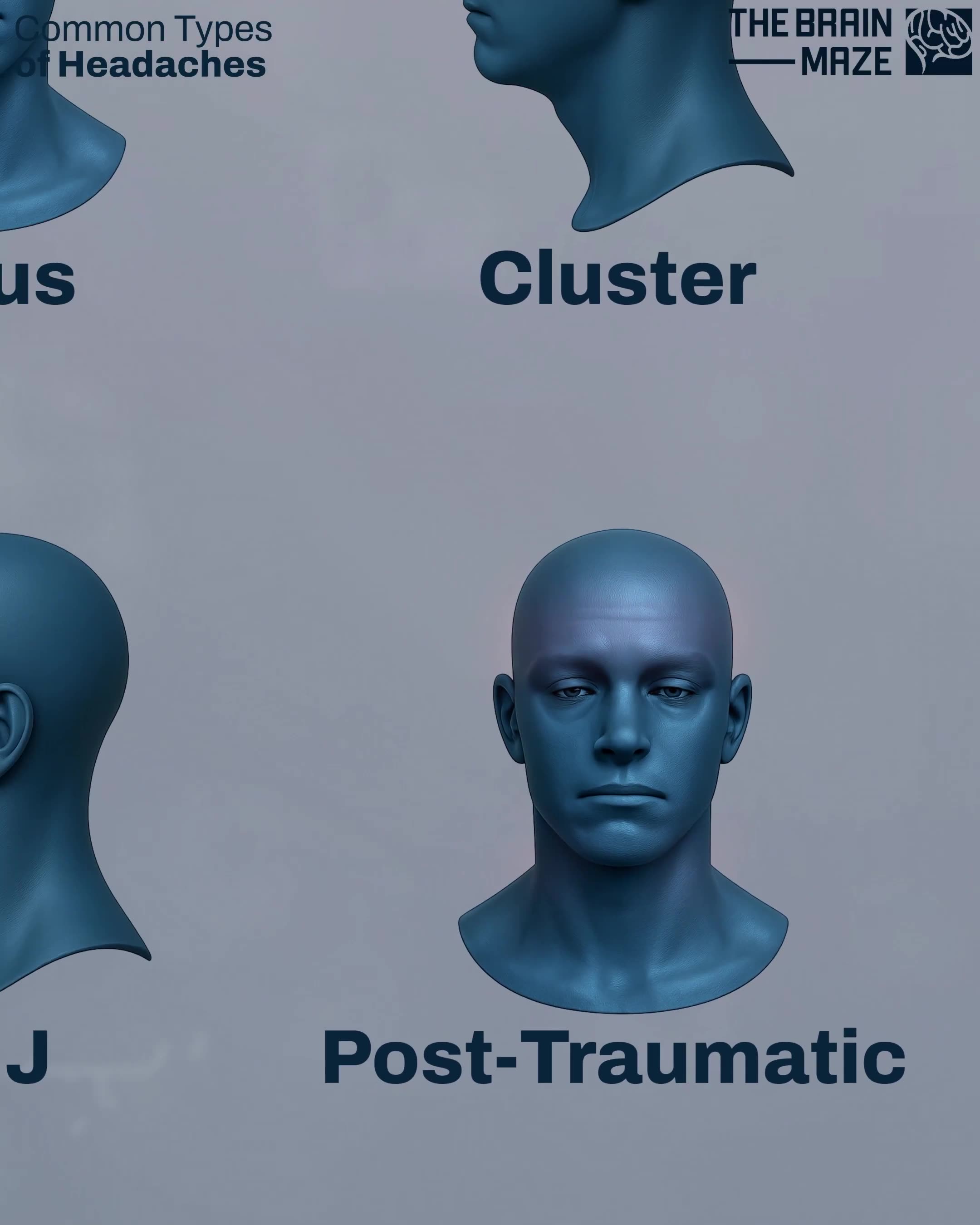 Visual guide to different types of headaches