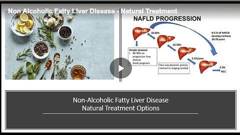 "Natural Treatments for Non-Alcoholic Fatty Liver Disease (NAFLD)"