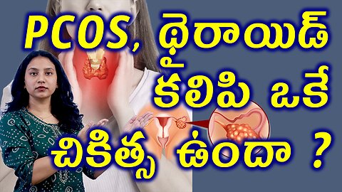 PCOS, థైరాయిడ్ కలిపి ఒకే చికిత్స ఉందా? Best Homeopathy Treatment for PCOS & Hypothyroidism Cure