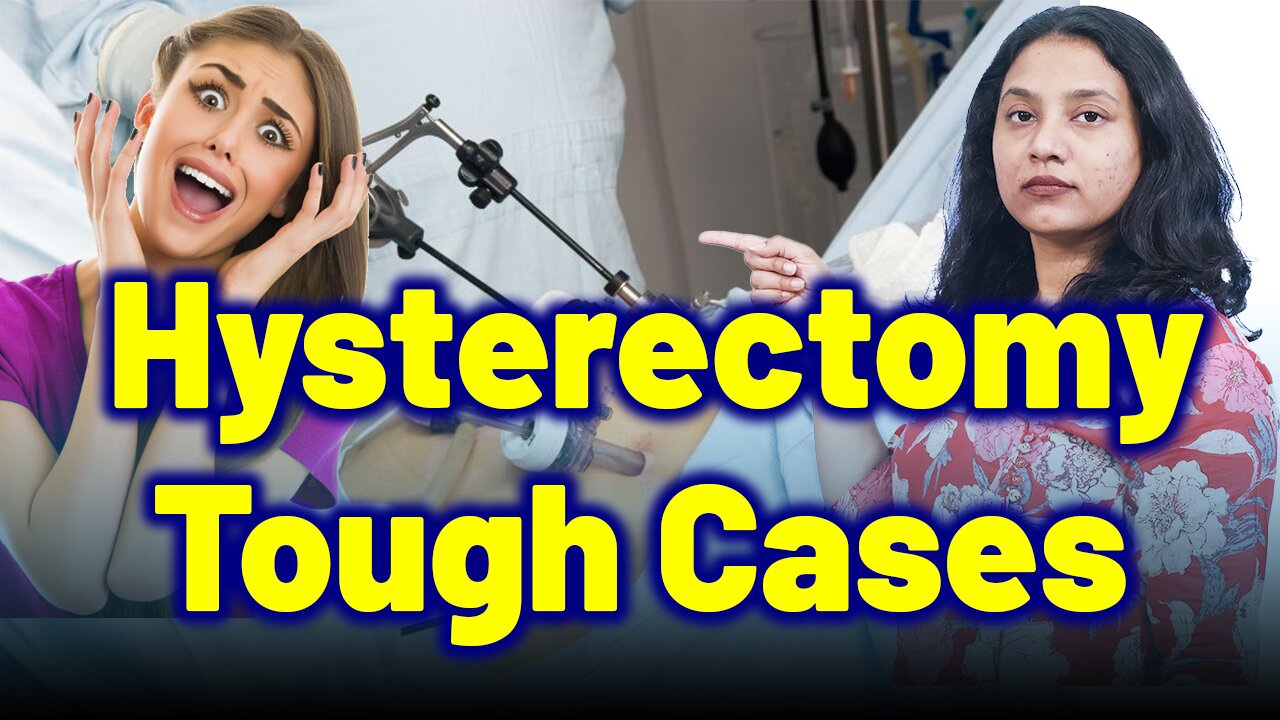 When to Avoid Robotic, Vaginal, Laparoscopic or Abdominal Hysterectomy for Fibroids | Treatment Cure