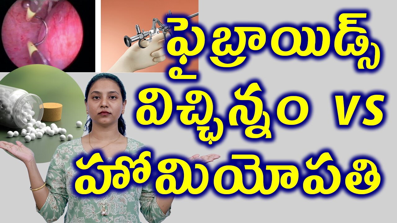 ఫైబ్రాయిడ్స్ విచ్ఛిన్నం vs హోమియోపతి How Homeopathy Better than Painless Faibroids Surgery Myolysis