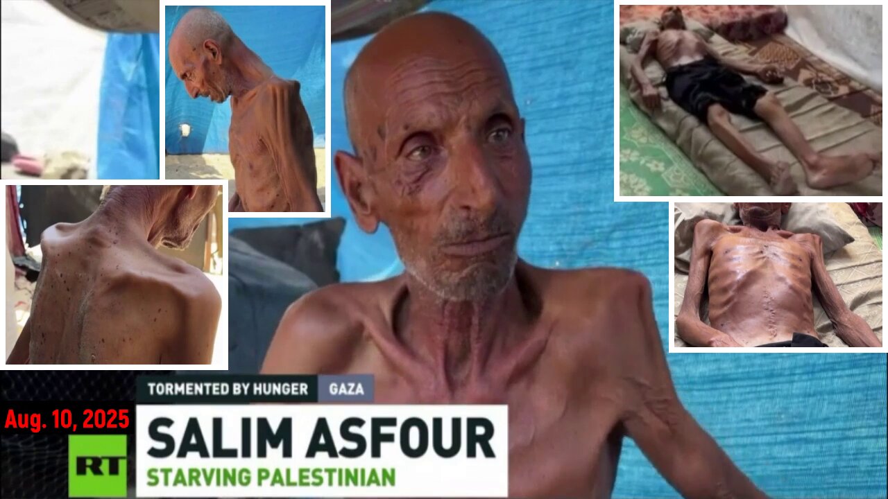 Gaza Is Being Tormented By Hunger