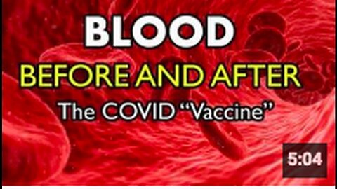"Comparative Analysis of Blood Pre and Post mRNA COVID Vaccination"