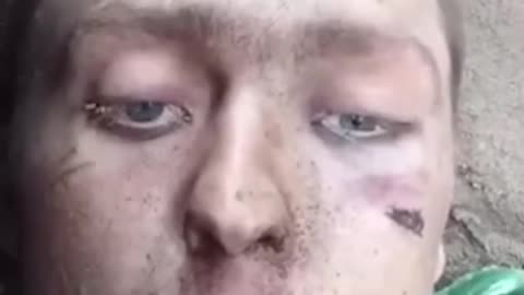 💔😢 Ukraine Russia War | Wounded Russian Soldier's Heartbreaking Last Words | RCF