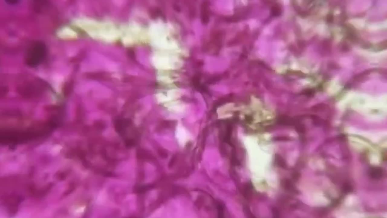 Worms in lipstick???!!!!