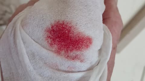 I cut my self on church doors on st georges day when lola died. Blood made a loveheart.