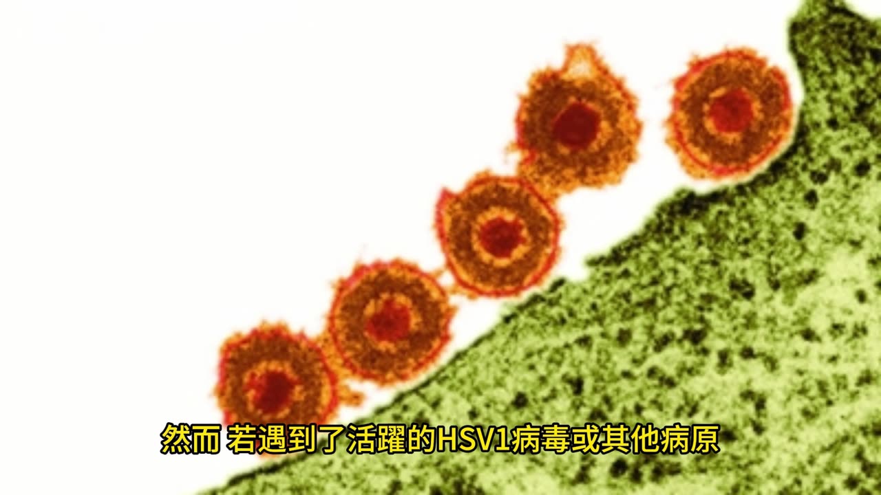 病毒釀失智？ 疫苗預防阿茲海默