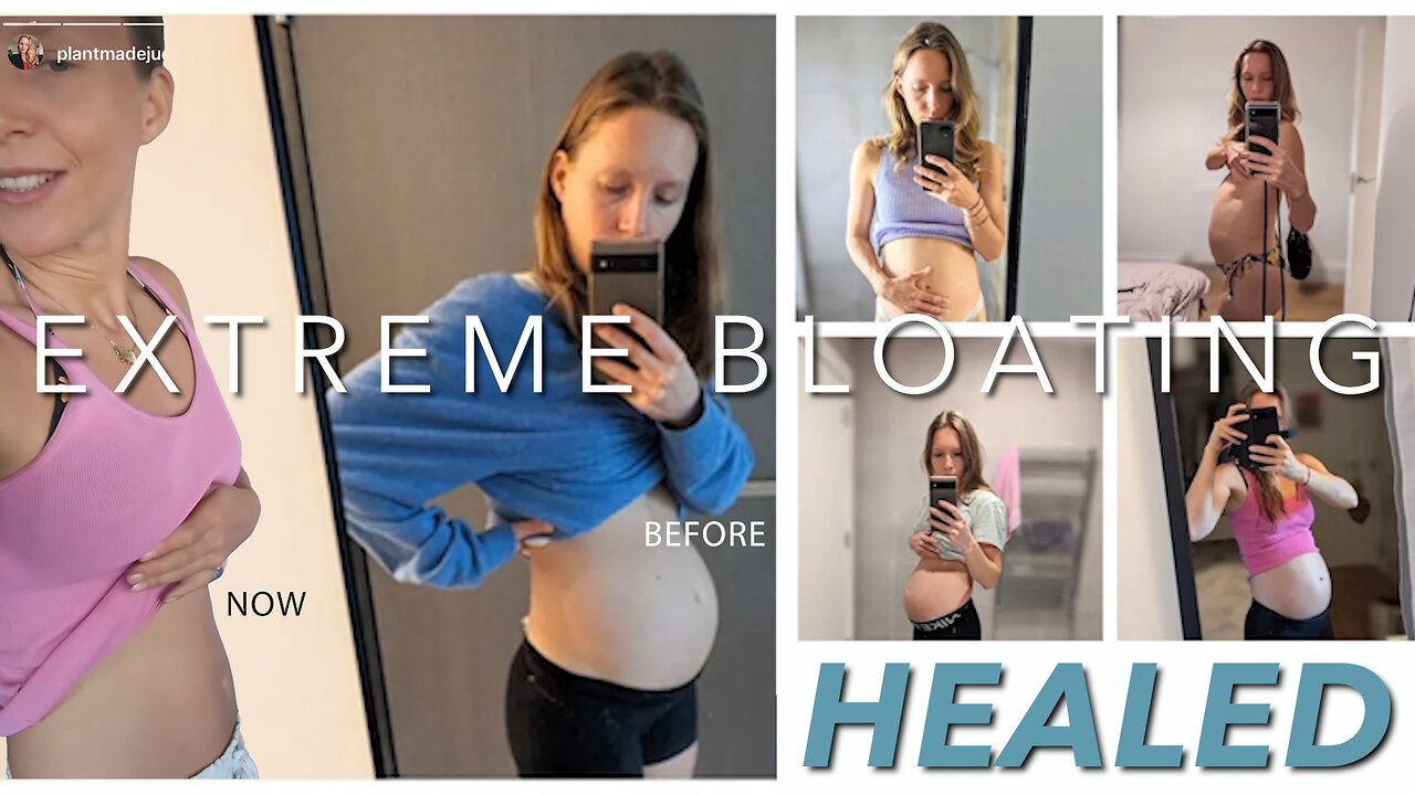 Extreme Bloating Healed