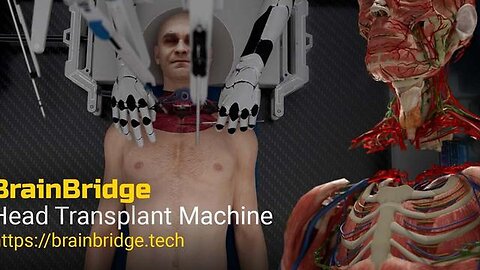 "Unveiling Brain Bridge: The Future of Automated Head Transplant Systems for Elites"