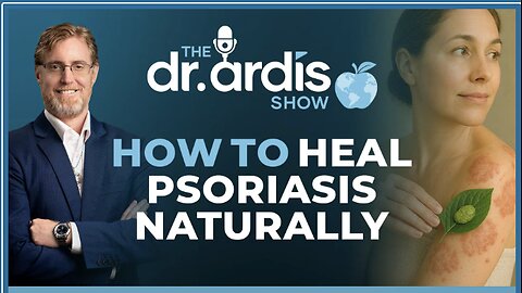 Dr. 'Bryan Ardis': How to Heal Psoriasis Naturally