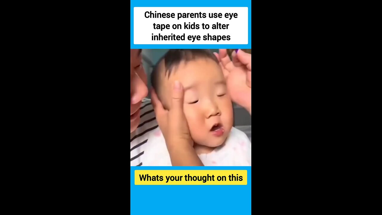 Chinese parents use eye tape on kids to alter inherited eye shapes