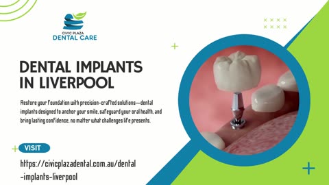 Osseointegration Redefined: Unveiling Premium Dental Implants in Liverpool