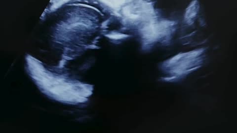 IVF, IUI, and ICSI Treatments at Sumathi Hospital: Your Path to Parenthood