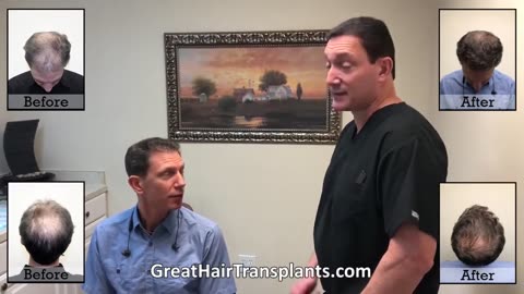 MaxHarvest™ Hair Restoration: Al’s Journey with Dr. Brett Bolton