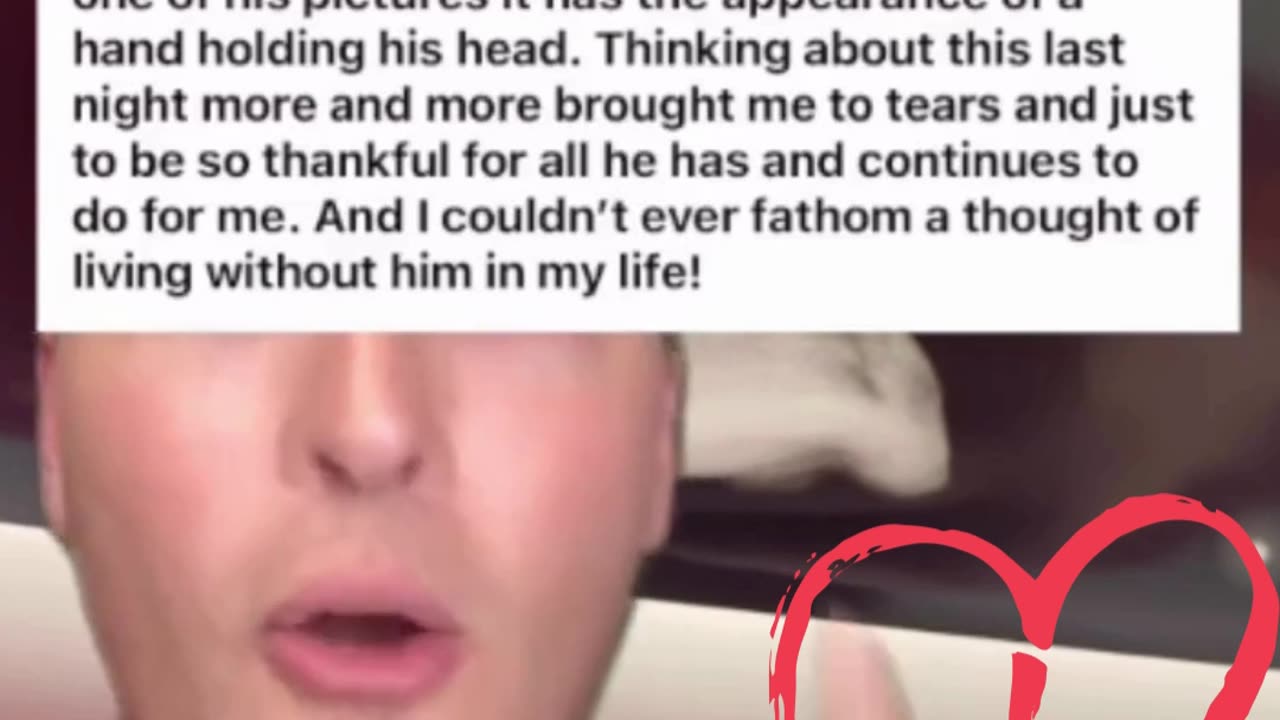 GODS HAND SHOWS UP ON AN ULTRASOUND