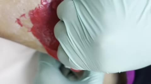 Underarm Waxing in Florida Using Sexy Smooth Cherry Desire Hard Wax | @firstglanceaesthetics