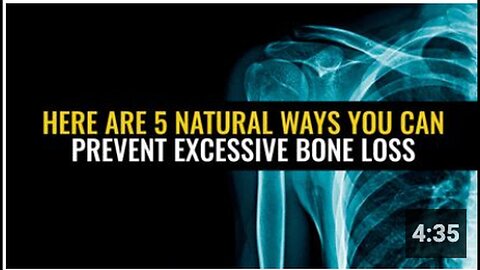 "5 Natural Methods to Prevent Excessive Bone Loss"