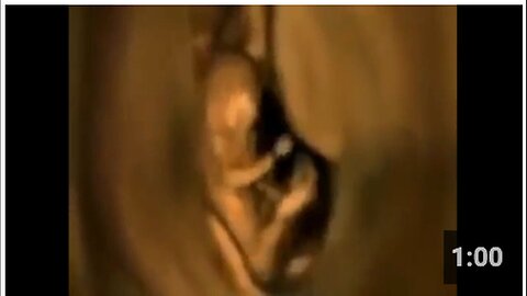 "Footage Reveals Activities of Unborn Babies in the Womb"