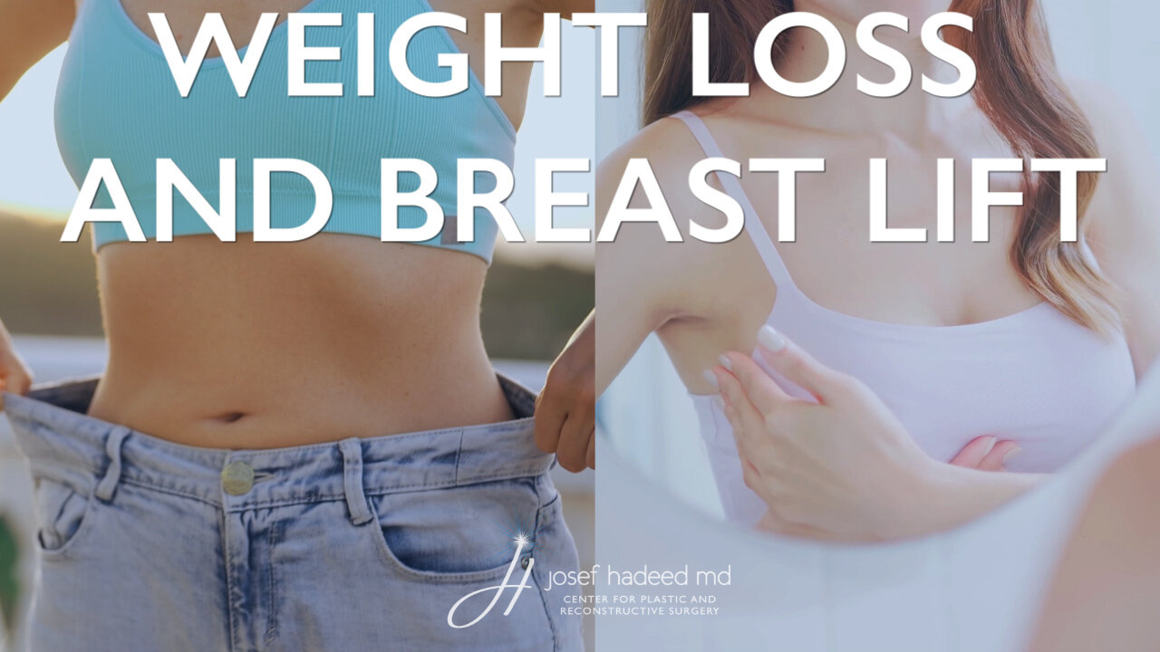 What Happens to the Breasts After Weight Loss? | Breast Lift Explained by Dr. Josef Hadeed