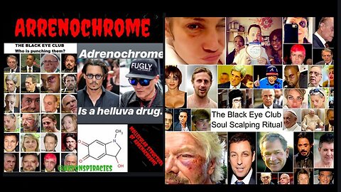 They are ALL Satanic Pedophile Cannibal Adrenochrome Psychopaths!
