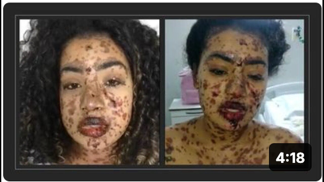 "Uncertain Circumstances Surrounding Ingrid Joao: A Worrying Scenario"