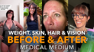 Weight, Skin, Hair & Vision Before & After Medical Medium