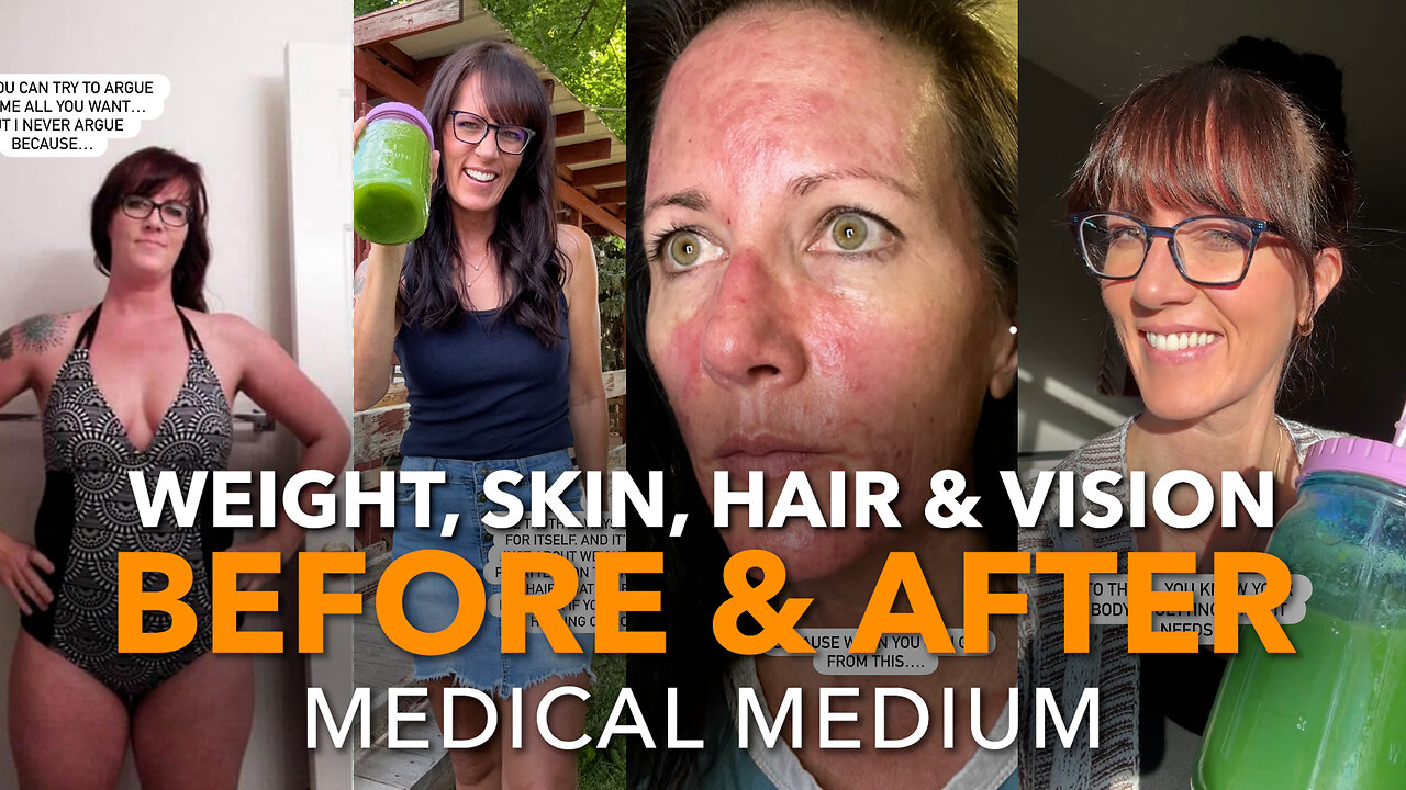 Weight, Skin, Hair & Vision Before & After Medical Medium