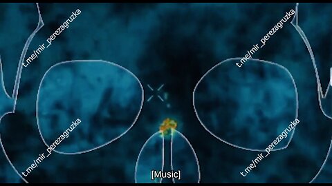 🇷🇺 🇺🇦 🏹 The Final Destination 2025: Pokrovsk 💥🪖