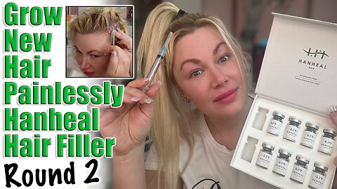 Grow New Hair Painlessly! Hanheal Hair Filler, Round 2! AceCosm.com and code Jessica10 Saves