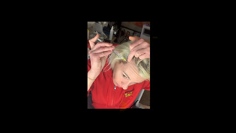 Scalp & Hand Mesotherapy for hydration and regeneration