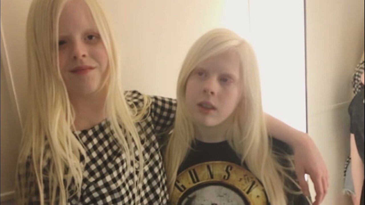 P249930YT BD AlbinismComp Youtube H264