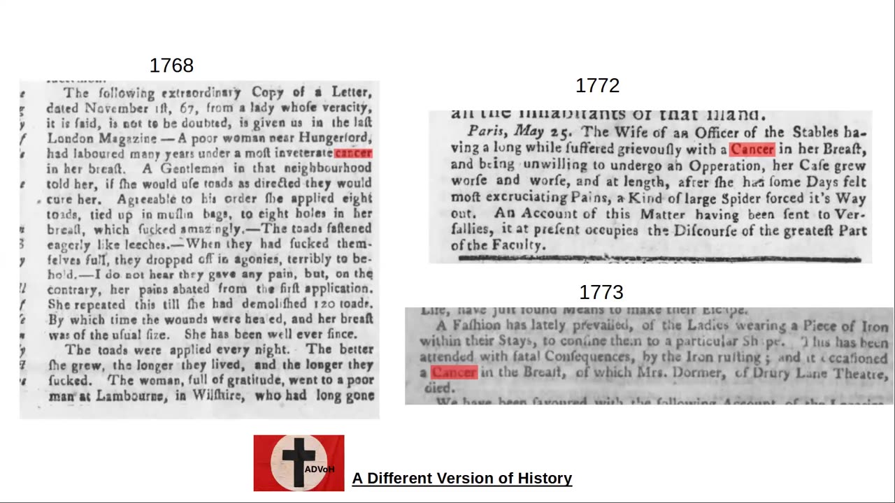 Odd Articles on Cancer from 1768 - 1773