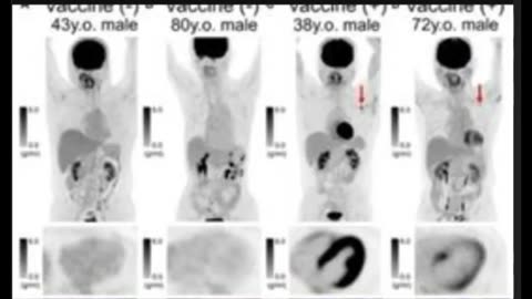 The Black Hearts Of The Jabbed...