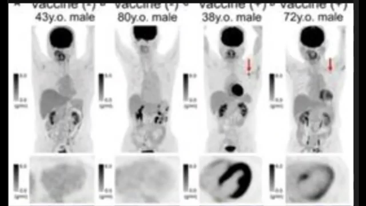 The Black Hearts Of The Jabbed...