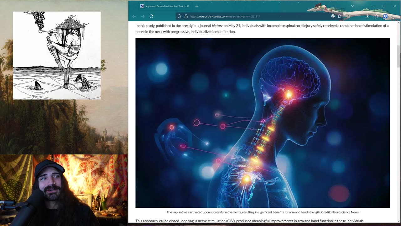 Implanted Device Restores Arm Function After Spinal Cord Injury