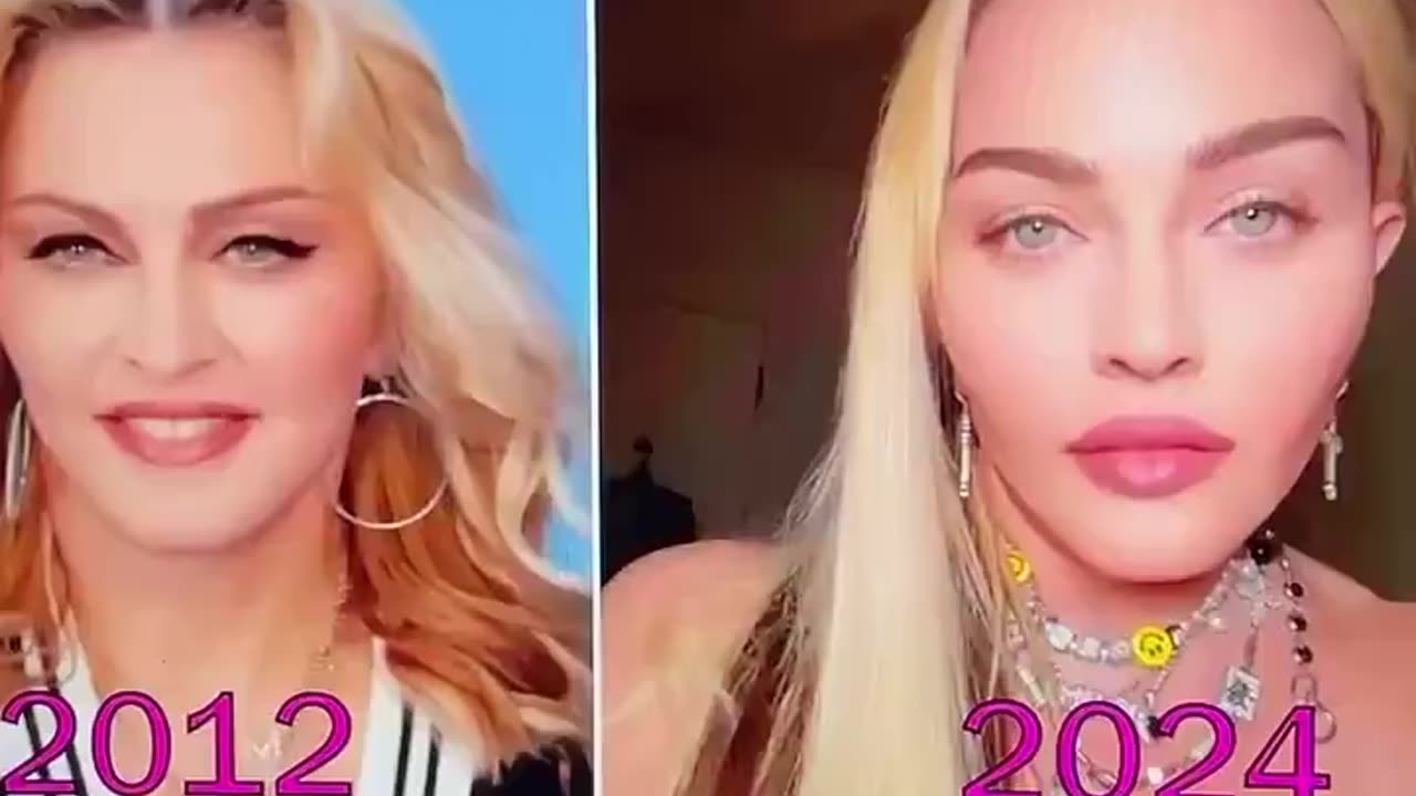 A D R E N O C H R O M E 🐰