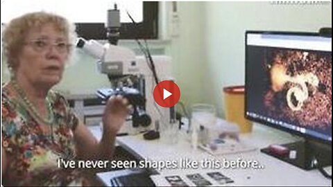 NEW GERMAN VAXXXED BLOOD / VAX SERUM (MICROSCOPE ANALYSIS) EXHIBITS & FINDINGS (WOR REPORT)