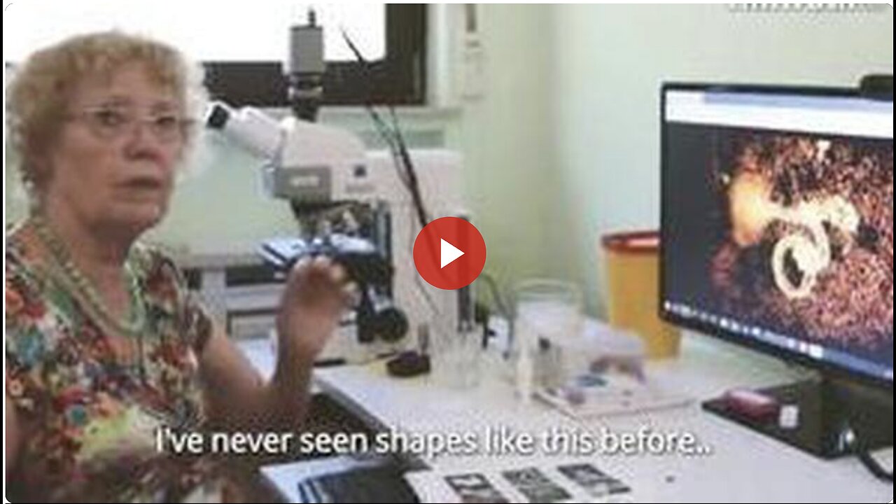 NEW GERMAN VAXXXED BLOOD / VAX SERUM (MICROSCOPE ANALYSIS) EXHIBITS & FINDINGS (WOR REPORT)