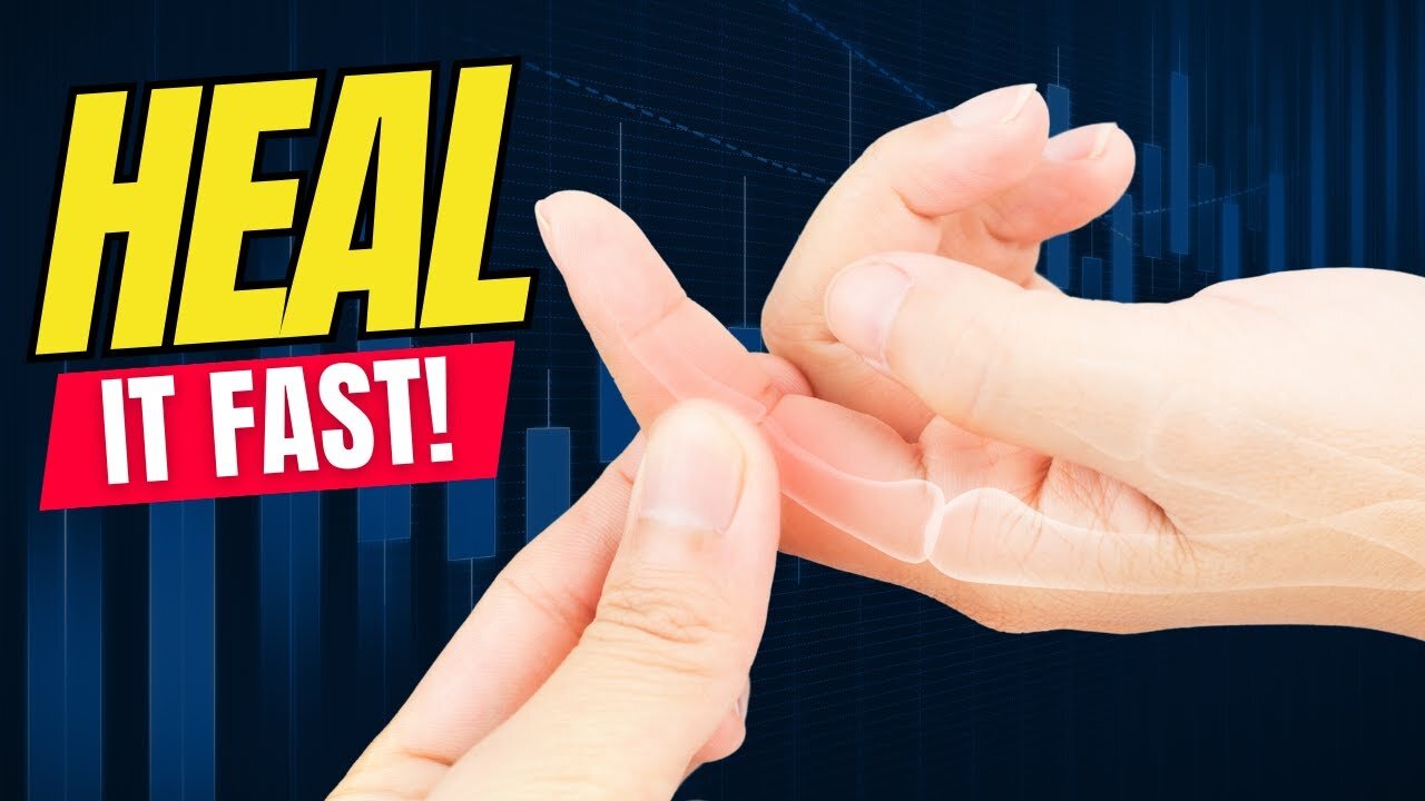 How To Treat A Jammed Finger
