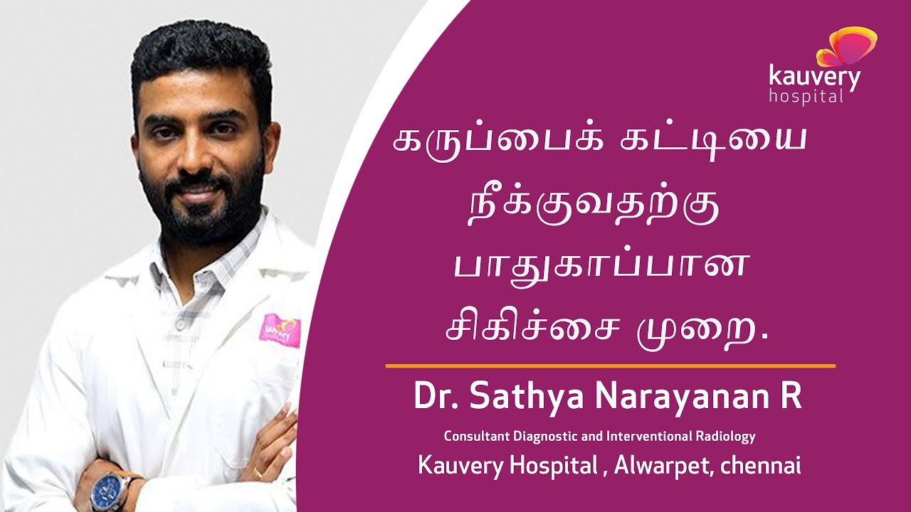 Safe Procedure to Remove Uterine Fibroids