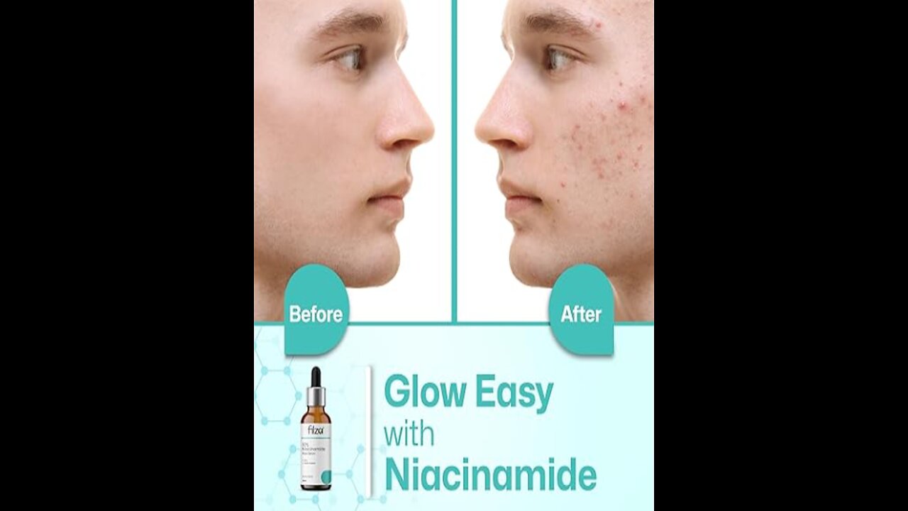 How to Find the Right Niacinamide Face Serum: A Quick Guide