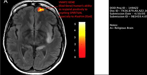 VMAT 2 GENE | HUMANITY'S GOD GENE DELETION THROUGH THE COVID 19 SHOTS