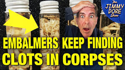 EMBALMERS REPORT PERSISTENT BLOOD CLOTS IN CORPSES ⚕ SINCE COVID VAX ROLLOUT❗ [COVIDIOCRACY KILLS]
