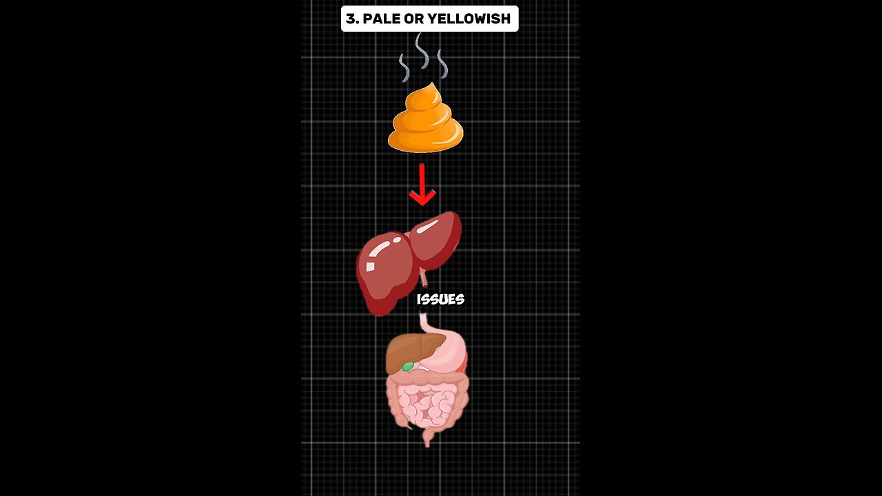 Your Poop Can Reveal Hidden Health Issues! 👀💩