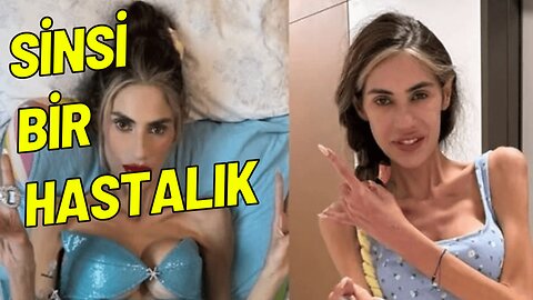 Nihal Candan'ın ölümüne sebep olan hastalık: Anoreksiya